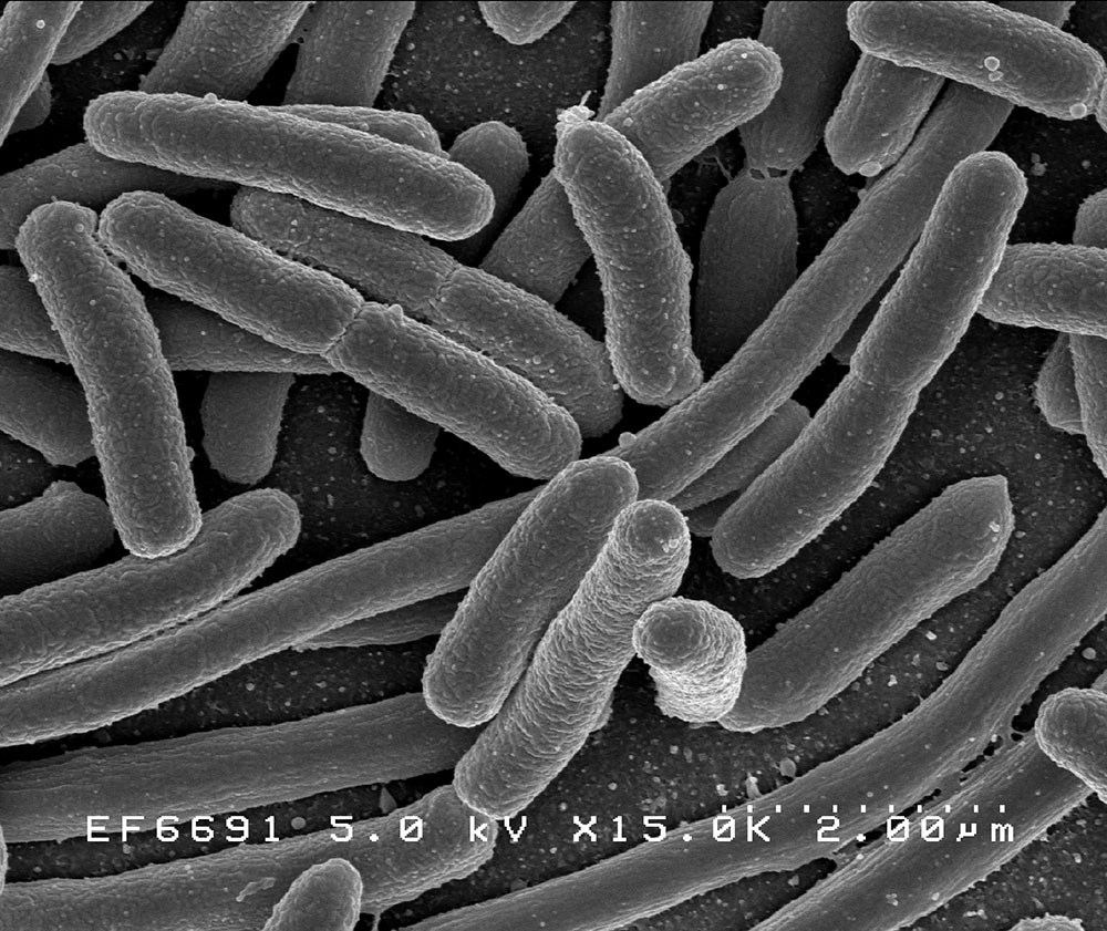 batteri Escherichia coli 