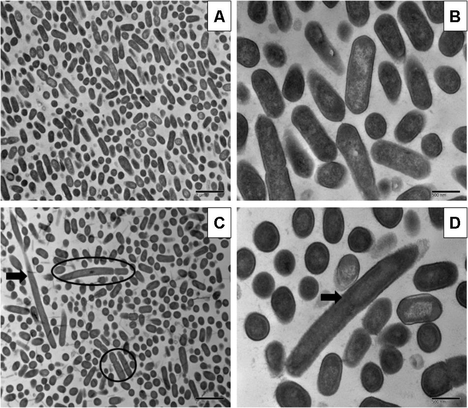 batterio Listeria monocytogenes